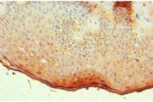Immunohistochemistry of paraffin-embedded human skin tissue using ABIN7144533 at dilution of 1:100 (ALOX15B 抗体  (AA 1-200))