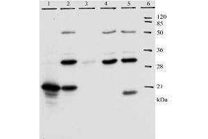 IP analysis of HPV-18 E7 protein. (HPV18 E7 抗体  (AA 36-70))