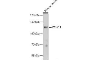 Western blot analysis of extracts of Mouse brain using WBP11 Polyclonal Antibody at dilution of 1:3000. (WBP11 抗体)