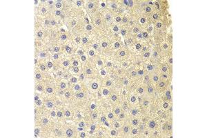 Immunohistochemistry of paraffin-embedded human liver injury using COMT antibody at dilution of 1:200 (400x lens). (COMT 抗体)