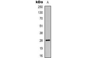Western blot analysis of HLA-DOA expression in HL60 (A) whole cell lysates. (HLA-DOA 抗体)