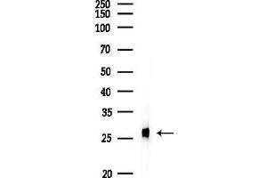 Western blot analysis of lysates from PC12 cells, using PGP9.