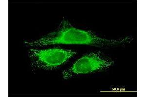 Immunofluorescence of purified MaxPab antibody to CRYZL1 on HeLa cell. (CRYZL1 抗体  (AA 1-113))