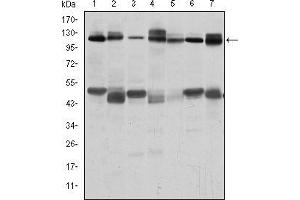 Western blot analysis using C-CBL mouse mAb against RAJI (1), RAW264. (CBL 抗体)