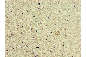 Immunohistochemistry of paraffin-embedded human brain tissue using ABIN7153807 at dilution of 1:100 (GTF2H5 抗体  (AA 1-71))