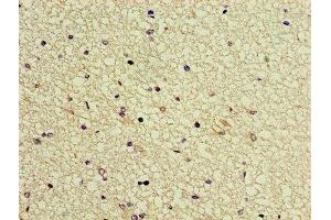 Immunohistochemistry of paraffin-embedded human brain tissue using ABIN7153807 at dilution of 1:100