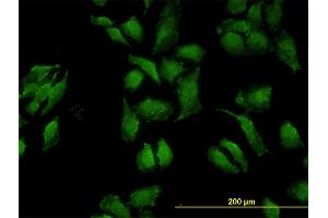 Immunofluorescence (IF) image for anti-Occludin (OCLN) (AA 423-522) antibody (ABIN562066)