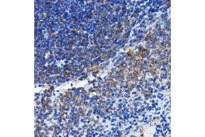 Immunohistochemistry of paraffin-embedded rat spleen using Bax antibody (ABIN7265858) at dilution of 1:100 (40x lens). (BAX 抗体)