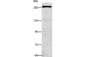 Western blot analysis of Raji cell, using ESPL1 Polyclonal Antibody at dilution of 1:500 (Separase 抗体)