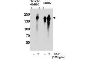 Western blot analysis of extracts from A431 cells, untreated or treated with EGF, using phospho-ERBB2 antibody (left) or nonphos Ab (right). (ErbB2/Her2 抗体  (pTyr1005))