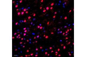 Immunofluorescence of paraffin embedded mouse brain using DMRTA2 (ABIN7073753) at dilution of 1: 650 (400x lens) (DMRTA2 抗体)