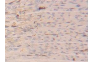 Immunohistochemistry (IHC) image for anti-Fatty Acid Binding Protein 4, Adipocyte (FABP4) (AA 2-132) antibody (ABIN7436912)