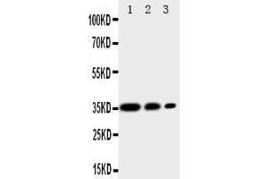 Anti-CD163 antibody, Western blottingAll lanes: Anti CD163  at 0. (CD163 抗体  (AA 1056-1165))