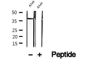 Western blot analysis of extracts of A549 cells, using STBD1 antibody. (STBD1 抗体  (N-Term))