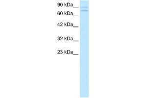 WB Suggested Anti-ZNF81 Antibody Titration:  0. (ZNF81 抗体  (Middle Region))