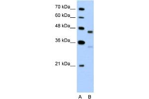 WB Suggested Anti-GPR161 Antibody Titration:  5. (GPR161 抗体  (C-Term))