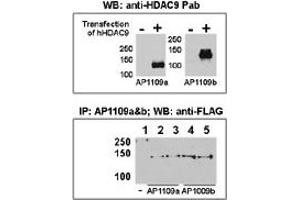 Both anti-HDAC9 N-term ((ABIN387960 and ABIN2844679)) and C-term ((ABIN387961 and ABIN2844680)) Pab were tested by WB and IP-WB using HeLa and HeLa-HDAC9 transfected cells. (HDAC9 抗体  (C-Term))