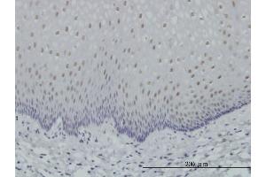 Immunoperoxidase of monoclonal antibody to RARA on formalin-fixed paraffin-embedded human esophagus. (Retinoic Acid Receptor alpha 抗体  (AA 315-424))