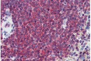 Human Spleen: Formalin-Fixed, Paraffin-Embedded (FFPE) (CA1 抗体  (AA 166-176))