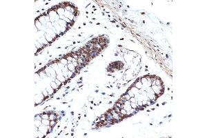 Immunohistochemistry (IHC) image for anti-High Mobility Group Box 2 (HMGB2) antibody (ABIN7267649)