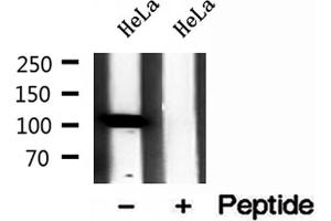 Western blot analysis of extracts of HeLa cells, using IPO4 antibody. (Importin 4 抗体  (Internal Region))