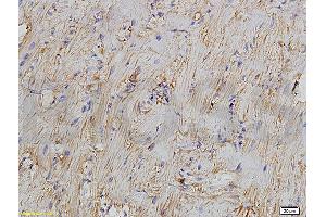 Formalin-fixed and paraffin embedded rat myocardium tissue labeled with Anti-Bcl-2 Polyclonal Antibody, Unconjugated (ABIN723920) 1:300 followed by conjugation to the secondary antibody and DAB staining (Bcl-2 抗体  (AA 101-160))