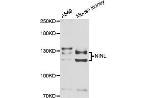 Western blot analysis of extracts of A549 and mouse kidney cell lines, using NINL antibody. (NINL 抗体)