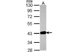WB Image Sample (30 ug of whole cell lysate) A: JurKat 10% SDS PAGE antibody diluted at 1:1000