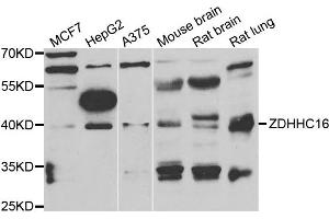 Western blot analysis of extracts of various cell lines, using ZDHHC16 antibody. (ZDHHC16 抗体)