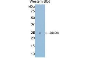 Western Blotting (WB) image for anti-Slit Homolog 1 (SLIT1) (AA 3-211) antibody (ABIN1176119) (SLIT1 抗体  (AA 3-211))