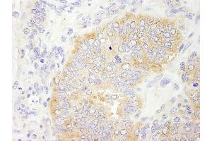 Immunohistochemistry (IHC) image for anti-eIF2beta/EIF2S2 (AA 283-333) antibody (ABIN7448545) (eIF2beta/EIF2S2 (AA 283-333) 抗体)