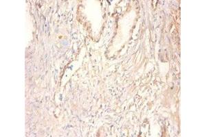 Immunohistochemistry of paraffin-embedded human prostate tissue using ABIN7148667 at dilution of 1:100 (CKMT1A 抗体  (AA 40-417))