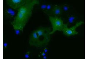 Anti-MOBKL2B mouse monoclonal antibody (ABIN2453319) immunofluorescent staining of COS7 cells transiently transfected by pCMV6-ENTRY MOBKL2B (RC205977). (MOBKL2B 抗体)