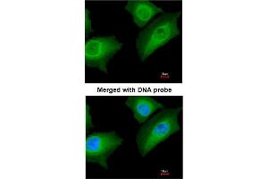 Immunofluorescence analysis of paraformaldehyde-fixed HeLa using AP31116PU-N ANXA1 antibody at 1/200 dilution.