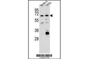 Western blot analysis in Sk-Br-3,T47D cell line lysates (35ug/lane). (CES4A 抗体  (C-Term))