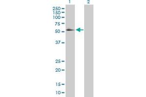 Western Blot analysis of RXRA expression in transfected 293T cell line by RXRA MaxPab polyclonal antibody. (Retinoid X Receptor alpha 抗体  (AA 1-462))