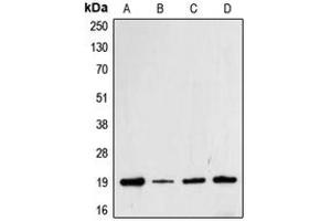 Western blot analysis of Cofilin (pS3) expression in Jurkat (A), HeLa (B), MCF7 (C), A431 (D) whole cell lysates. (Cofilin 抗体  (N-Term, pSer3))