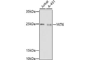 Western blot analysis of extracts of various cell lines, using YKT6 antibody (ABIN7271424) at 1:1000 dilution. (YKT6 抗体)