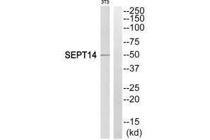 Western blot analysis of extracts from NIH/3T3 cells, using SEPT14 antibody. (Septin 14 抗体  (C-Term))