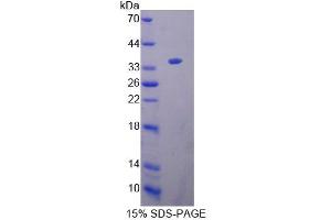 SDS-PAGE analysis of Mouse KEL Protein. (KEL 蛋白)
