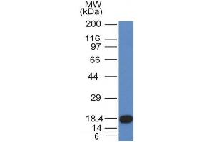 Image no. 1 for anti-Mast/stem Cell Growth Factor Receptor (KIT) (AA 100-300) antibody (ABIN6190751) (KIT 抗体  (AA 100-300))