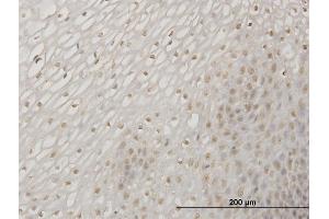 Immunoperoxidase of monoclonal antibody to ERN1 on formalin-fixed paraffin-embedded human esophagus. (ERN1 抗体  (AA 401-500))