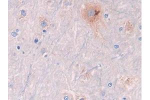 DAB staining on IHC-P; Samples: Rat Spinal cord Tissue (GLB1 抗体  (AA 338-570))