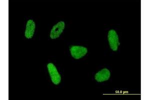 Immunofluorescence of purified MaxPab antibody to RNF168 on HeLa cell. (RNF168 抗体  (AA 1-571))