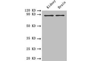 Western blot All lanes: PTPRE antibody at 0. (PTPRE 抗体)