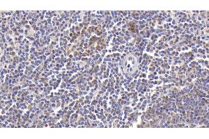 Detection of CXCL2 in Human Spleen Tissue using Polyclonal Antibody to Chemokine (C-X-C Motif) Ligand 2 (CXCL2) (CXCL2 抗体  (AA 34-107))
