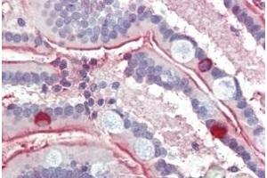 Immunohistochemistry (IHC) image for anti-Solute Carrier Family 5 (Sodium/glucose Cotransporter), Member 1 (SLC5A1) (Internal Region) antibody (ABIN7013885)