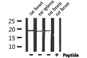 Western blot analysis of extracts from rat heart ,rat spleen and rat brain, using PTP4A3 Antibody. (PTP4A3 抗体  (C-Term))