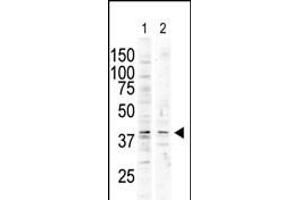 The anti-P38delta C-term Pab (ABIN6242133 and ABIN6578997) is used in Western blot to detect P38 delta in nocodazole-treated HC (lane 1) and A-treated Pam212 (lane 2) cell lysates. (MAPK13 抗体  (C-Term))