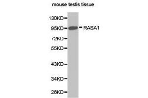Western Blotting (WB) image for anti-RAS P21 Protein Activator (GTPase Activating Protein) 1 (RASA1) antibody (ABIN1874554) (RASA1 抗体)